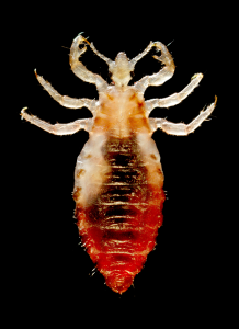 Head Louse, or Pediculus humanus capitis by Dr. Dennis D. Juranek of the CDC