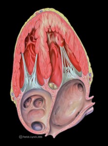 "Heart with Anterior Wall Dysfunction" by Patrick J. Lynch