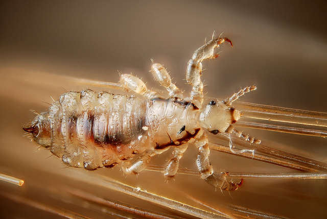 Pediculus humanus capitis, the human head louse, image by Gilles San Martin
