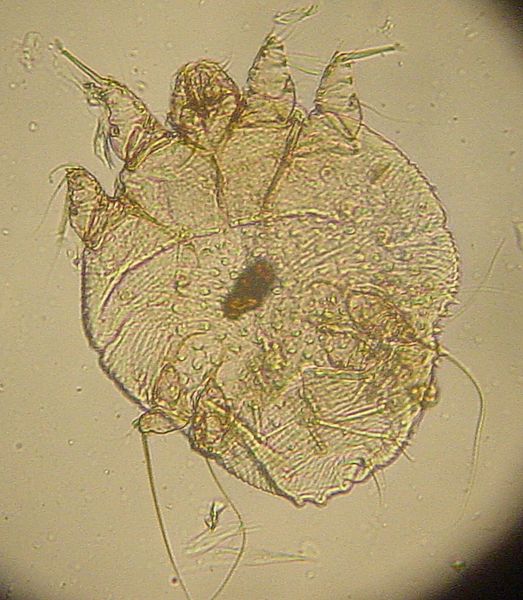 "Image of Sarcoptes scabei, the Adult Scabies Mite" by Kalumet
